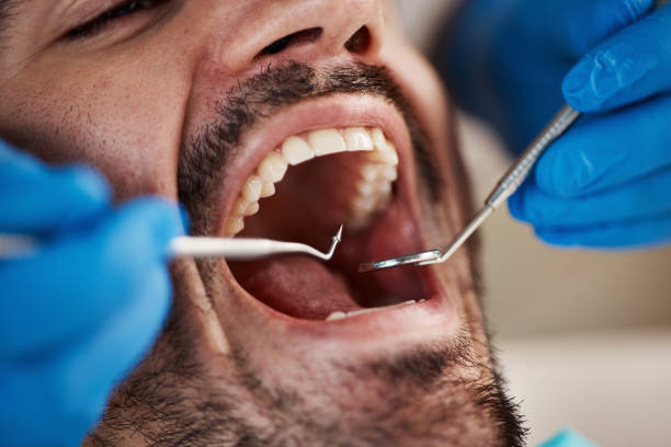 Best Pediatric Emergency Dentist in Holly Lake Ranch, TX