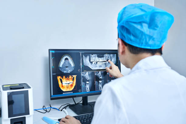 Best Emergency Dental Care for Abscessed Tooth in Holly Lake Ranch, TX